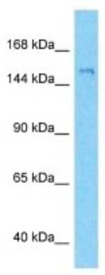 Western Blot: SCAP Antibody [NBP3-09965]