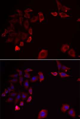 Immunocytochemistry/ Immunofluorescence: SCAP2 Antibody - BSA Free [NBP2-94017]