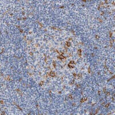 Immunohistochemistry-Paraffin: SCAP2 Antibody [NBP2-47289]