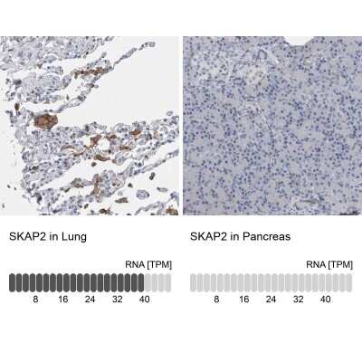 Immunohistochemistry-Paraffin: SCAP2 Antibody [NBP2-47289]