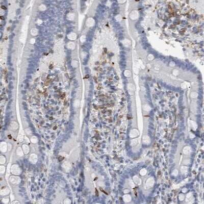 Immunohistochemistry-Paraffin: SCAP2 Antibody [NBP2-47289]