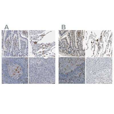 Immunohistochemistry-Paraffin: SCAP2 Antibody [NBP2-47289]