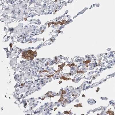 Immunohistochemistry-Paraffin: SCAP2 Antibody [NBP2-47289]