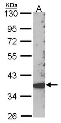 Western Blot: SCAP2 Antibody [NBP1-31033]