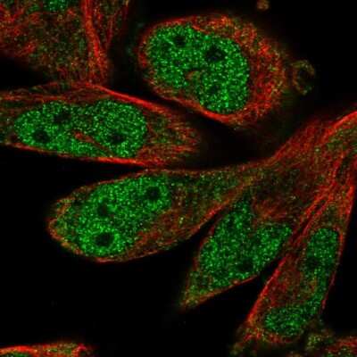 Immunocytochemistry/ Immunofluorescence: SCAPER Antibody [NBP2-56827]