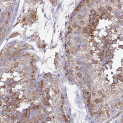 Immunohistochemistry-Paraffin: SCAPER Antibody [NBP2-13285]