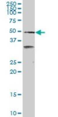 Western Blot: SCARA3 Antibody (3A2) [H00051435-M01]