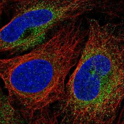 Immunocytochemistry/ Immunofluorescence: SCARA3 Antibody [NBP2-56837]