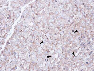Immunohistochemistry-Paraffin: SCARA3 Antibody [NBP1-32130]