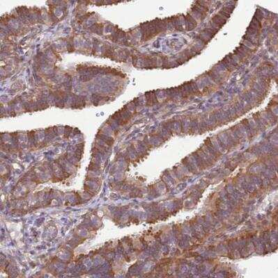 Immunohistochemistry-Paraffin: SCARA3 Antibody [NBP2-13286]