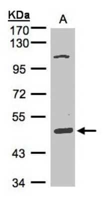 Western Blot: SCARA3 Antibody [NBP1-32130]