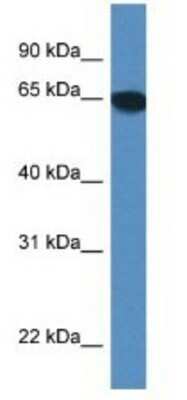 Western Blot: SCARA3 Antibody [NBP1-79201]