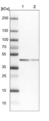 Western Blot: SCARA3 Antibody [NBP2-13286]