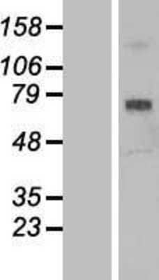 Western Blot: SCARA3 Overexpression Lysate [NBL1-15719]