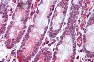 Immunohistochemistry-Paraffin: SCARA5 Antibody - BSA Free [NBP1-72121]