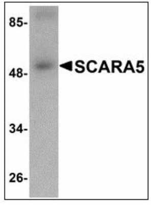 Western Blot: SCARA5 AntibodyBSA Free [NBP1-72121]