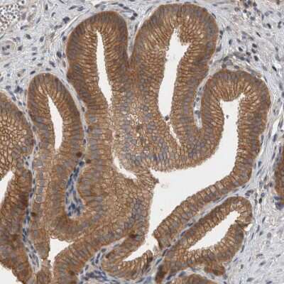 Immunohistochemistry-Paraffin: SCARA5 Antibody [NBP1-83572]