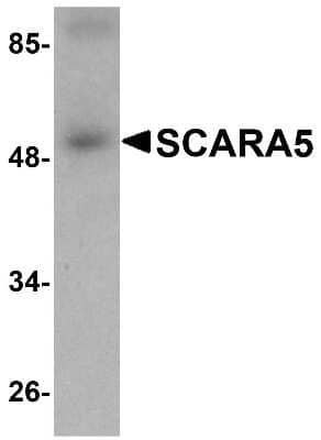 Western Blot: SCARA5 AntibodyBSA Free [NBP1-77050]