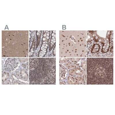 Immunohistochemistry-Paraffin: SCC112 Antibody [NBP2-38313]