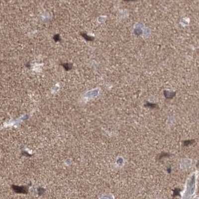Immunohistochemistry-Paraffin: SCC112 Antibody [NBP2-38313]