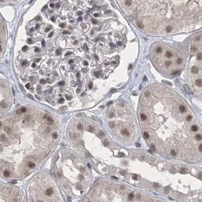 Immunohistochemistry-Paraffin: SCC112 Antibody [NBP2-38313]