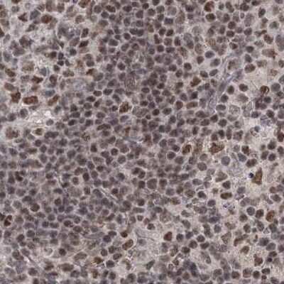 Immunohistochemistry-Paraffin: SCC112 Antibody [NBP2-38313]