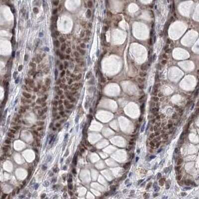Immunohistochemistry-Paraffin: SCC112 Antibody [NBP2-38313]