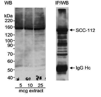 Western Blot: SCC112 Antibody [NB100-426]