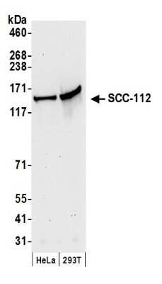 Western Blot: SCC112 Antibody [NB100-426]