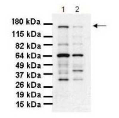 Western Blot: SCC112 Antibody [NBP1-57664]