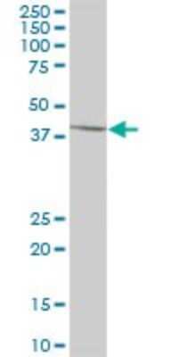 Western Blot: SCCPDH Antibody [H00051097-B01P]