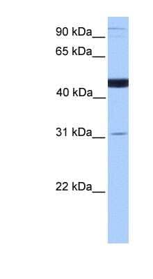 Western Blot: SCCPDH Antibody [NBP1-60126]