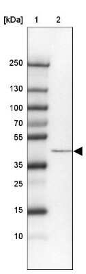 Western Blot: SCCPDH Antibody [NBP2-13287]