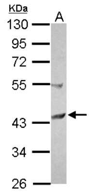 Western Blot: SCCPDH Antibody [NBP2-20267]