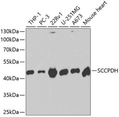 Western Blot: SCCPDH AntibodyBSA Free [NBP2-94306]