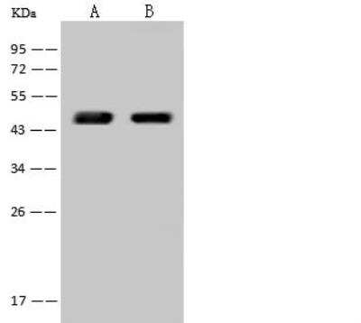 Western Blot: SCCPDH Antibody [NBP2-97630]