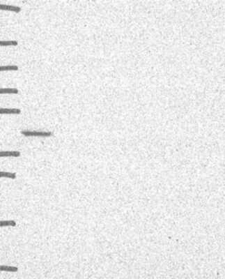 Western Blot: SCCPDH Antibody [NBP3-17042]