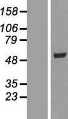 Western Blot: SCCPDH Overexpression Lysate [NBL1-15723]