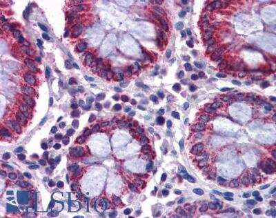 Immunohistochemistry-Paraffin: SCD-1 Antibody [NB100-2476]