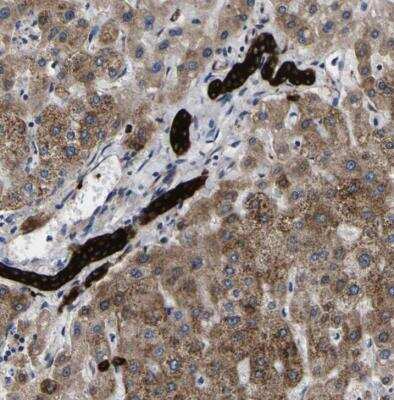 Immunohistochemistry-Paraffin: SCD-1 Antibody [NBP1-84749]