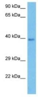 Western Blot: SCD-2 Antibody [NBP3-10121]