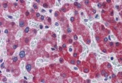 Immunohistochemistry-Paraffin: SCD-1 Antibody [NB100-2476]