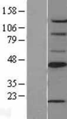 Western Blot: SCD-1 Overexpression Lysate [NBL1-15724]