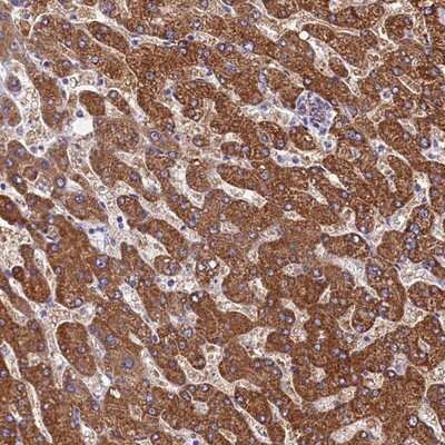 Immunohistochemistry-Paraffin: SCD5 Antibody [NBP1-89274]