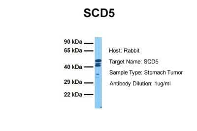 Western Blot: SCD5 Antibody [NBP2-83498]