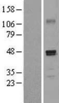 Western Blot: PDGF-D/SCDGFB Overexpression Lysate [NBL1-14237]