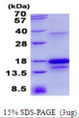 SDS-PAGE: Recombinant Human PDGF-D/SCDGFB His Protein [NBP2-23335]