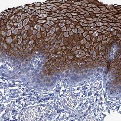 Immunohistochemistry-Paraffin: SCEL Antibody [NBP1-82137]