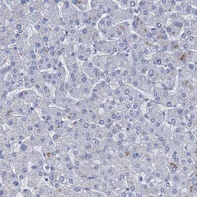 Immunohistochemistry-Paraffin: SCEL Antibody [NBP1-82137]