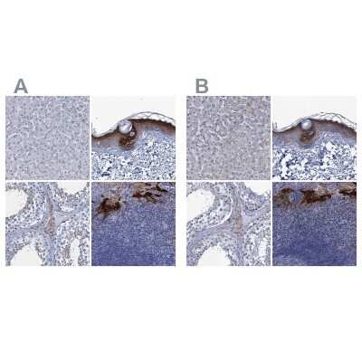 Immunohistochemistry-Paraffin: SCEL Antibody [NBP1-82137]